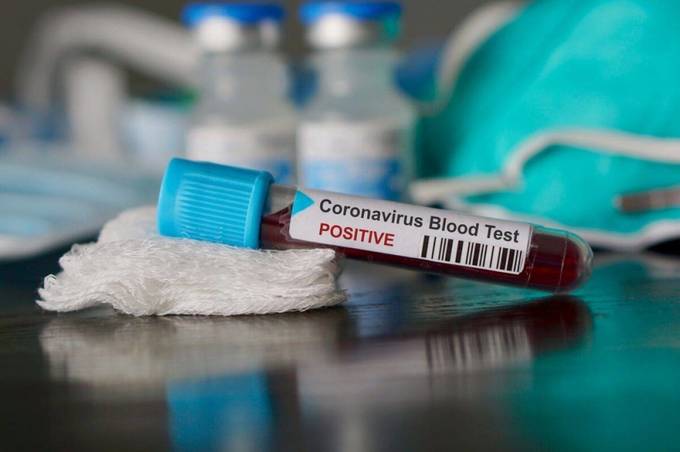 У Вінниці від коронавірусу помер лікар "Пироговки"