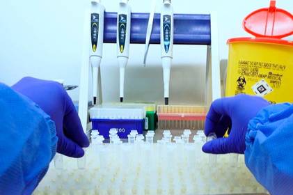 «Дельта» на Вінниччині: чи не пропускає ПЛР-тест нові штами коронавірусу?

