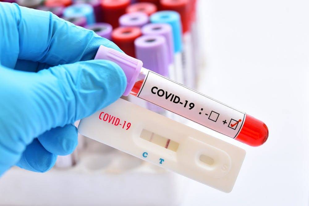 За добу на Вінниччині 929 нових випадків хворих на COVID-19