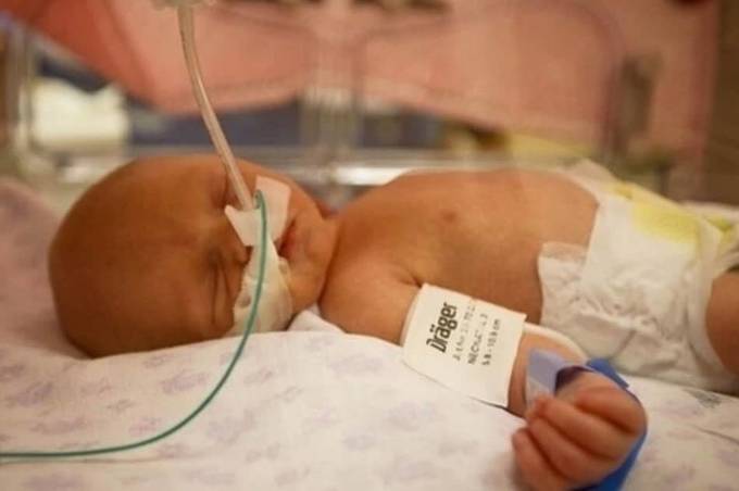 Обладнання, яке допоможе врятувати життя крихіток, подарували Вінницькій обласній дитячій клінічній лікарні