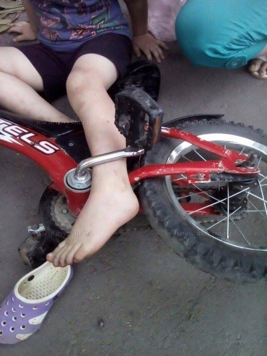 6-річний вінничанин потрапив у "пастку" велосипеда - аби звільнити ногу хлопчика викликали рятувальників