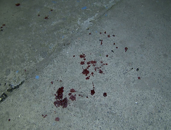 Вночі на вул. Замостянській вибухнула граната. Загинув 20-річний військовий, ще троє поранено