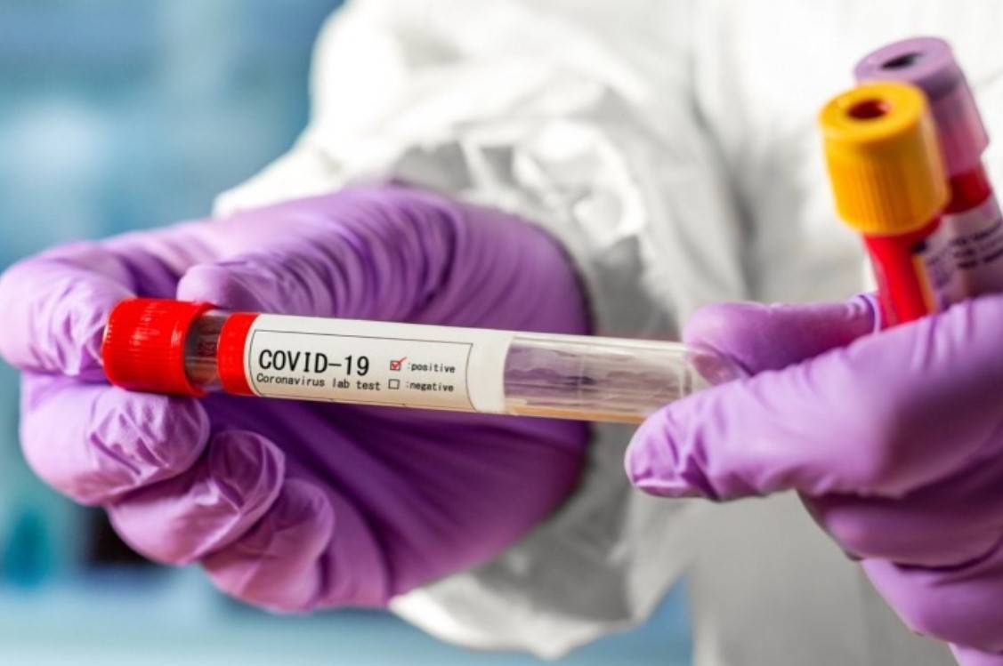 У Вінниці продовжує зростати кількість нових захворювань на COVID-19