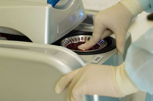 Муніципальна ПЛР-лабораторія зможе досліджувати до 600 тестів за добу