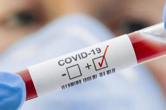 У Вінниці за добу на коронавірус захворіло 122 людини 