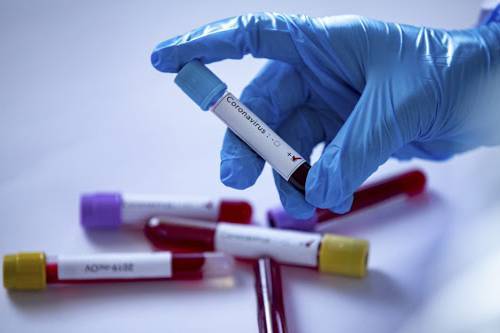 У Вінниці на коронавірус за добу захворіло 37 людей