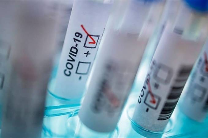 У Вінниці виявили 87 нових випадків коронавірусу