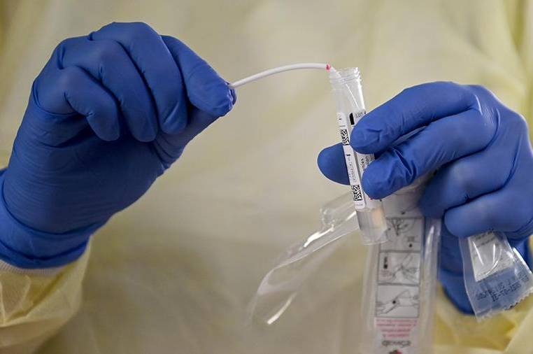 У Вінниці за добу коронавірус виявили у 24х людей