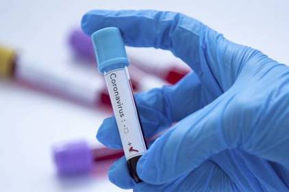 Більш ніж 100 нових випадків коронавірусу зафіксували у Вінниці за добу 