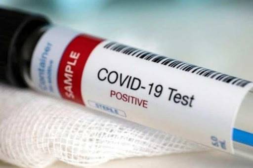 На Вінниччині за минулу добу виявлено 604 нових випадки інфікування коронавірусом  

