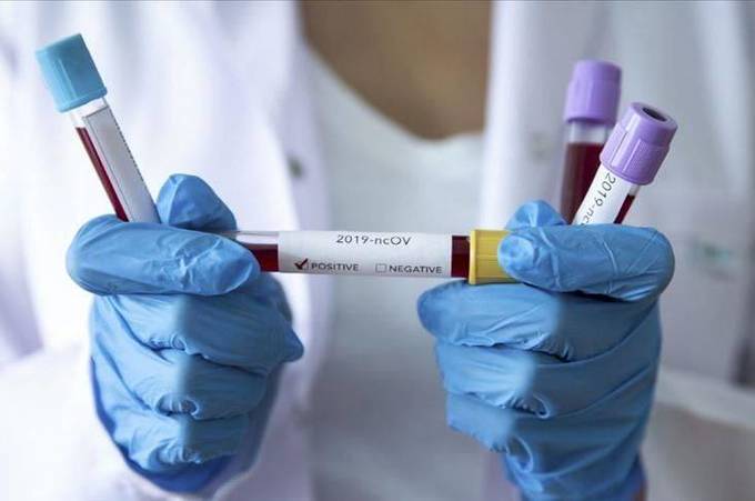 На Вінниччині 640 нових випадків інфікування коронавірусом  

