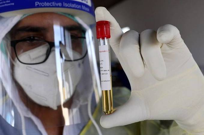 За минулу добу на Вінниччині на коронавірус захворіло 20 людей 


