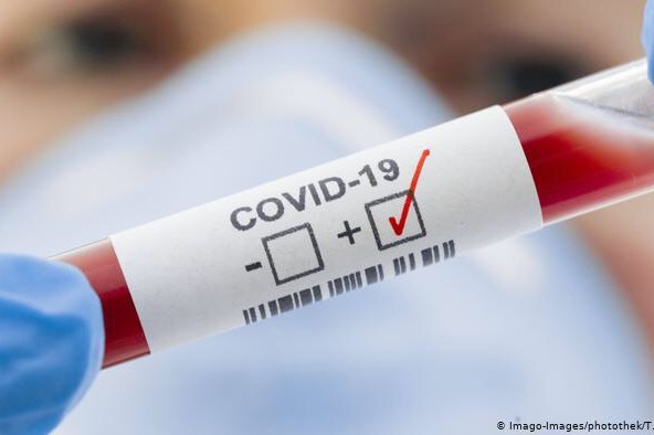 COVID-19: за минулу добу 12 інфікованих на Вінниччині
