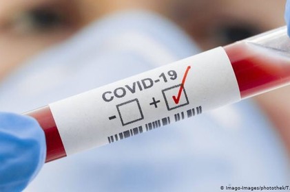 COVID-19: за минулу добу 12 інфікованих на Вінниччині
