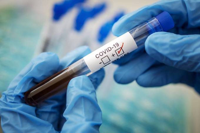 Серед вінничан 50 нових випадків коронавірусу