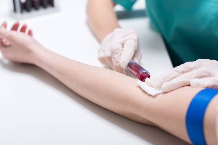У Вінниці триває тиждень безкоштовного тестування на вірусні гепатити 