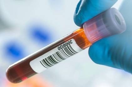 Вчені винайшли тест, який виявляє ознаки раку в крові