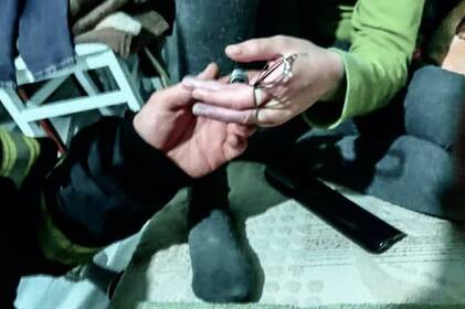 У Вінниці рятувальники допомогли 9-річній дівчинці врятувати пальчики: подробиці У Вінниці рятувальники допомогли 9-річній дівчинці врятувати пальчики: подробиці