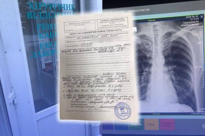 У Вінниці двоє підлітків побили 14-річного хлопця біля магазину на Келецькій: що відомо