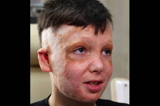 Ромчик Олексів переніс 36-ту операцію після ракетного удару росіян по Вінниці (відео)