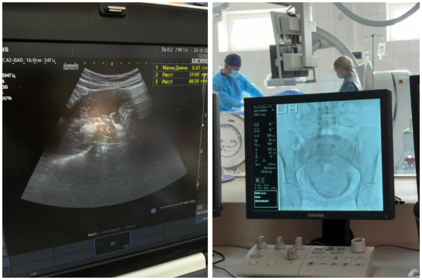 У Вінниці врятували життя молодої матері та зберегли її репродуктивну функцію