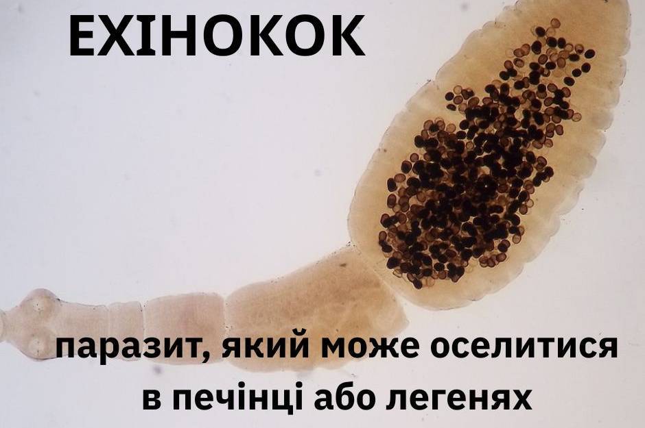 Паразит, який роками «мовчить»: що потрібно знати про ехінококоз