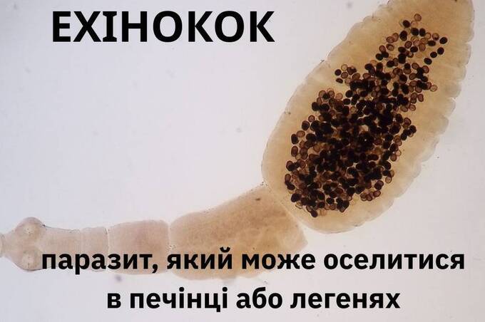 Паразит, який роками «мовчить»: що потрібно знати про ехінококоз