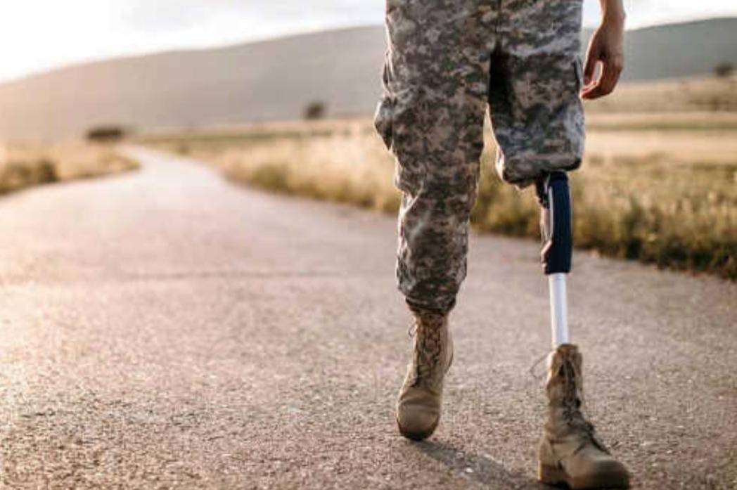У Вінниці ветерани з ампутаціями можуть отримати відшкодування за оздоровлення: як отримати виплату