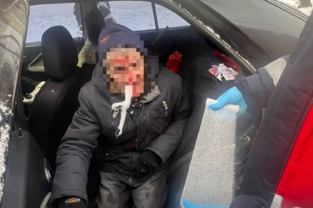 На Пирогова у Вінниці Chery збив 69-річного чоловіка (відео)