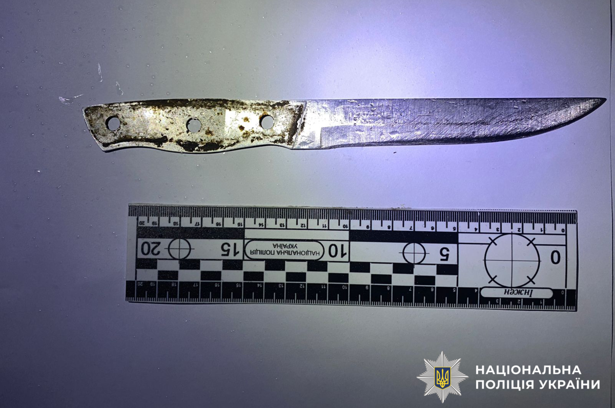 Конфлікт між братами на Вінниччині завершився ножовим пораненням: що відомо