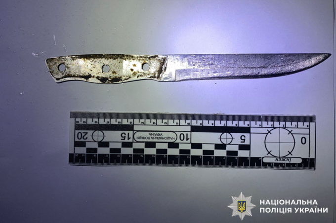 Конфлікт між братами на Вінниччині завершився ножовим пораненням: що відомо