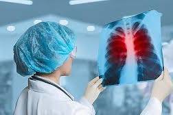 Майже 40 випадків туберкульозу зафіксували на Вінниччині в лютому