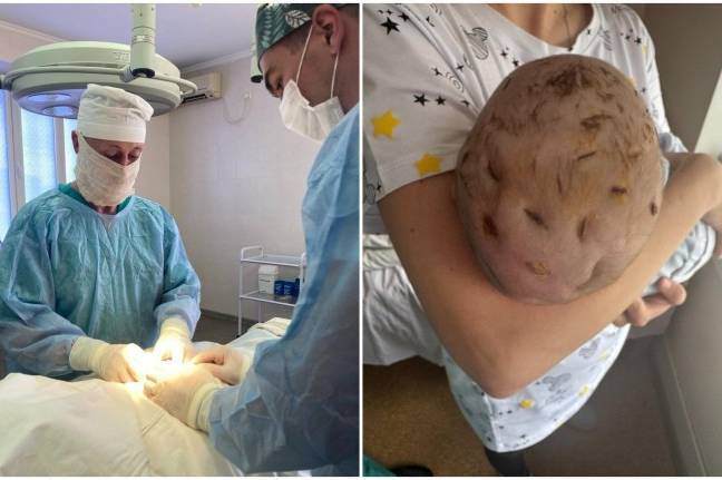 Вінницькі лікарі врятували тримісячну дитину з гнійним запаленням шкіри голови