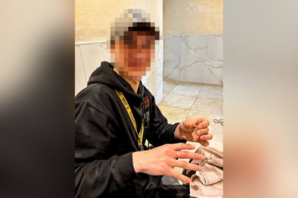 Перстень врізався в палець: у Вінниці рятувальники допомогли 20-річному хлопцю