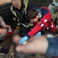 На Вінниччині за добу загинули двоє чоловіків через нещасні випадки