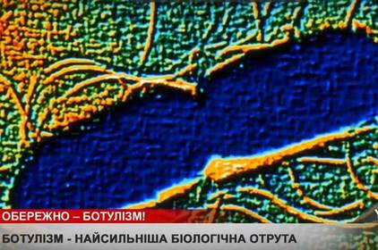 За минулі вихідні зафіксовано два випадки ботулізму