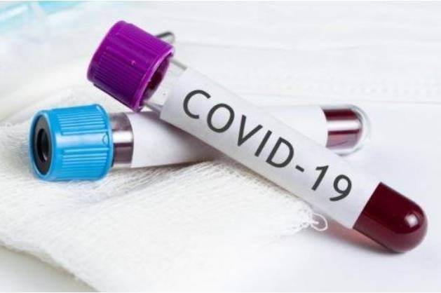 У Вінниці лабораторно підтверджено 89 випадків захворювання на COVID-19